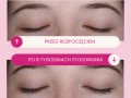 Efekty działania serum Lashes2Love