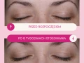 Efekty działania serum Lashes2Love