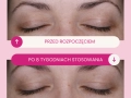Efekty działania serum Lashes2Love